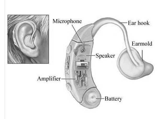 parts of hearing aid diagram