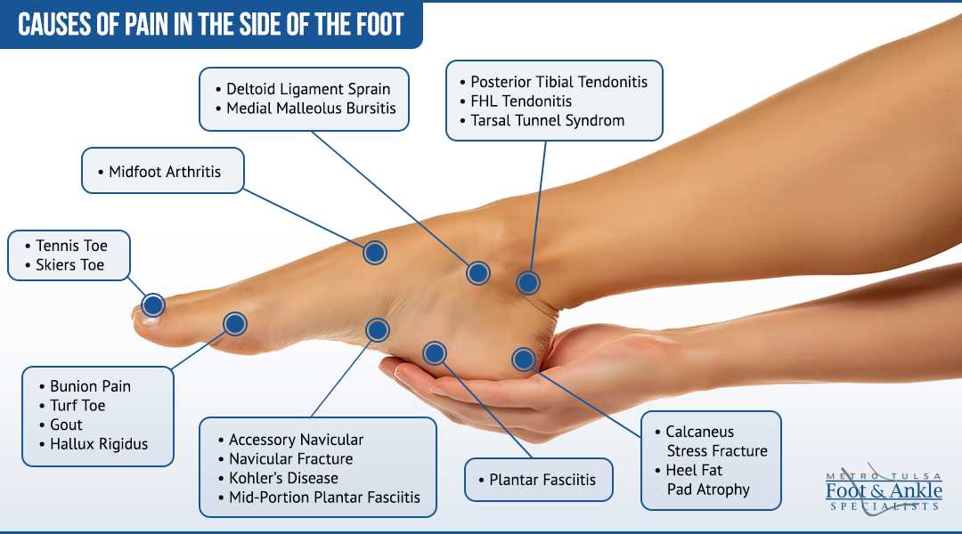 parts of the bottom of the foot diagram