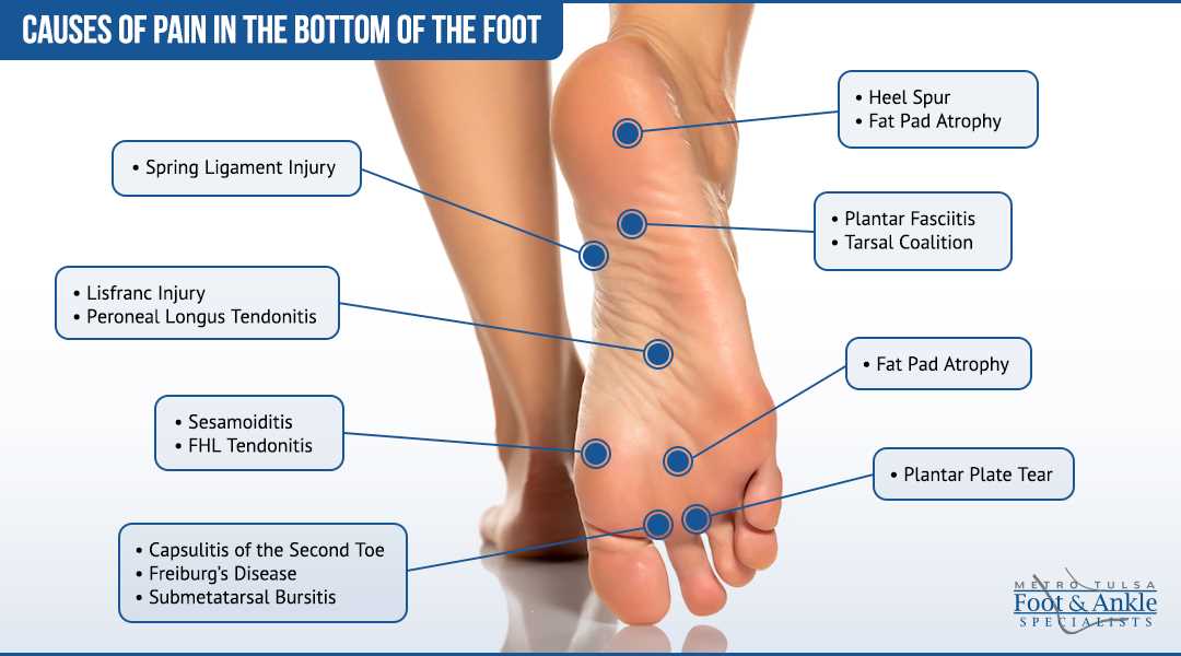 parts of the bottom of the foot diagram