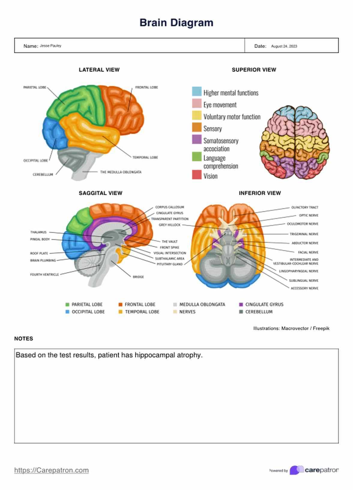 parts of the brain and what they do diagram