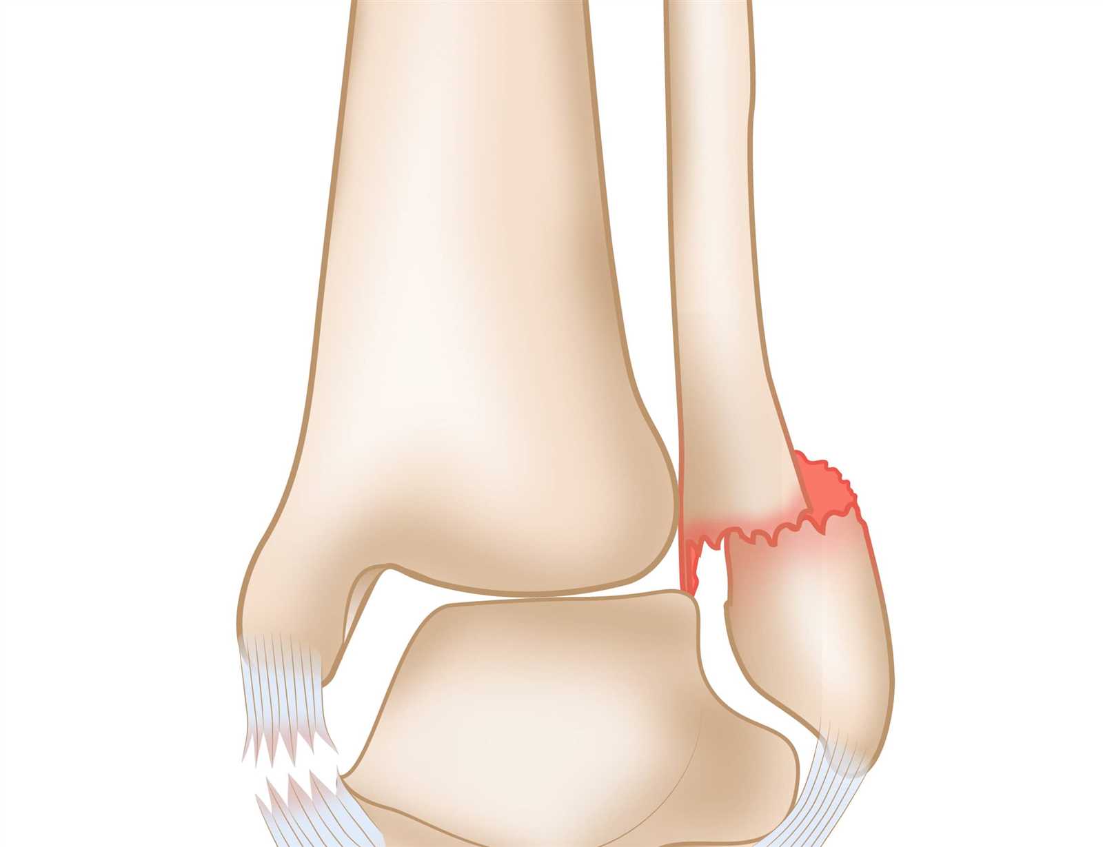 parts of the ankle diagram