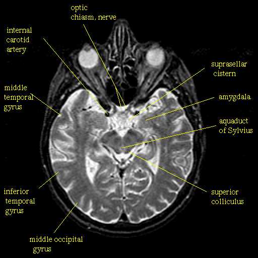 parts of the brain diagram quiz