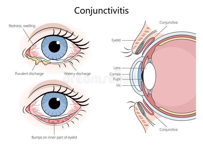 parts of the eyelid diagram