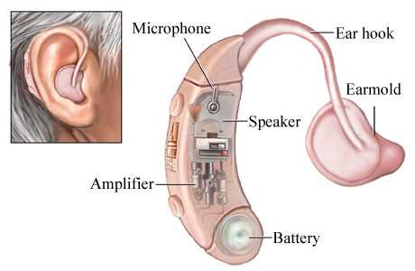 phonak hearing aid parts diagram